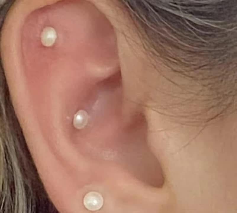 Chamilidots ear seed kits