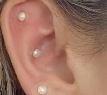 Chamilidots ear seed kits